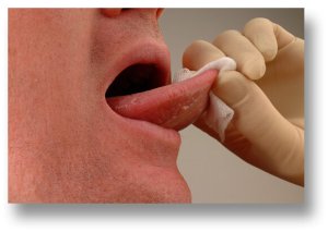 penyebab lidah terasa pahit padahal tidak sakit